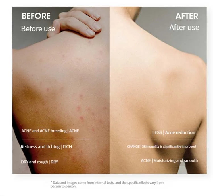 Brosse de Douche en Silicone Antidérapante – Massage & Soin du Corps